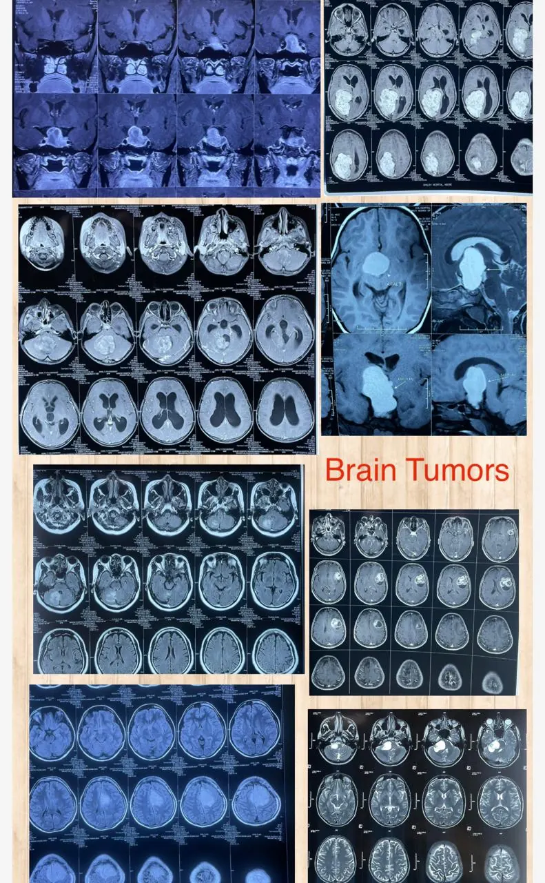 Dr. Abhishek Songara Instagram — Angel Brain & Spine Centre, Indore