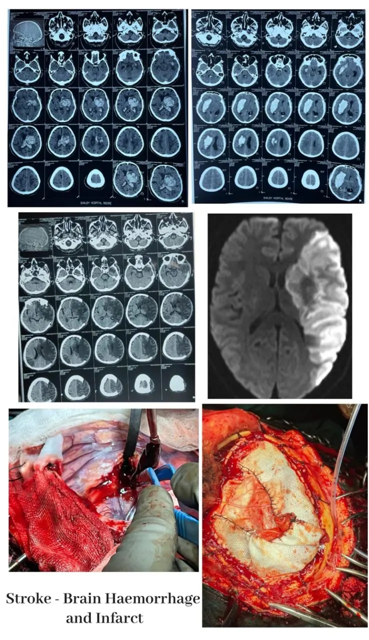 Dr. Abhishek Songara Instagram — Angel Brain & Spine Centre, Indore