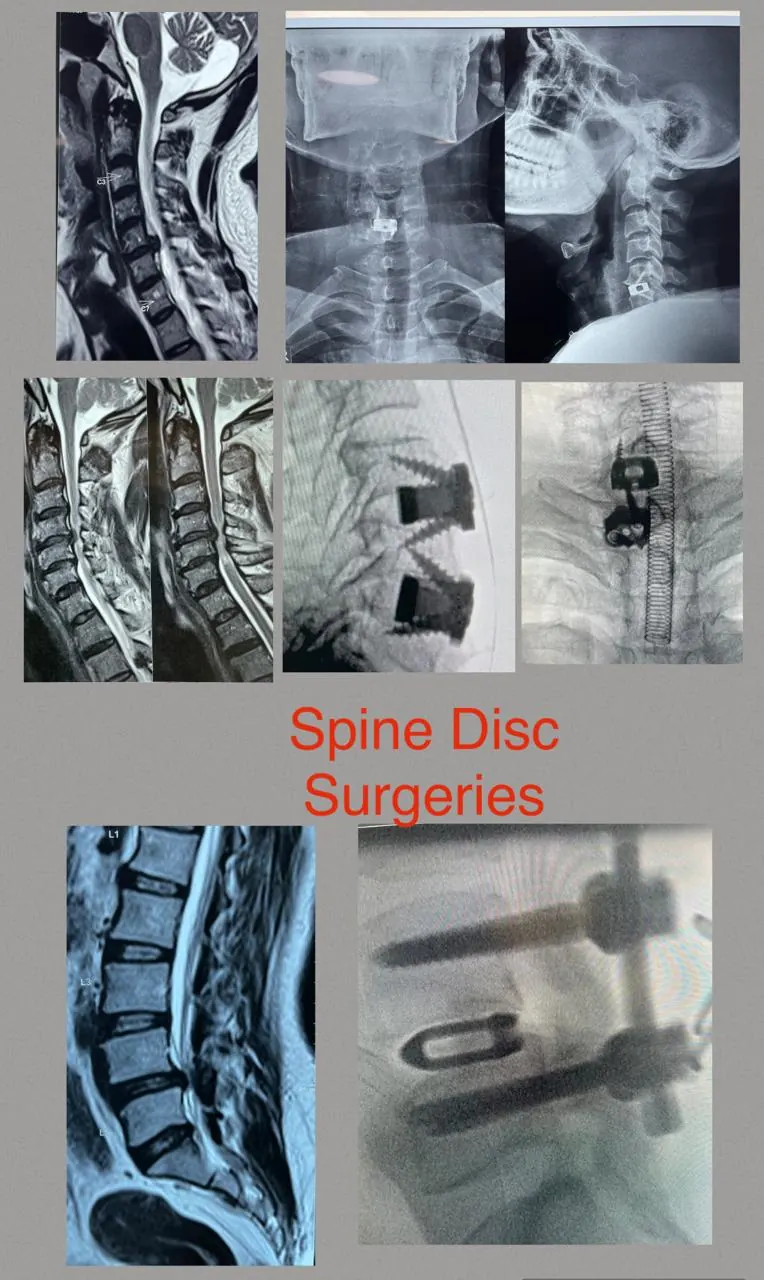 Dr. Abhishek Songara Instagram — Angel Brain & Spine Centre, Indore