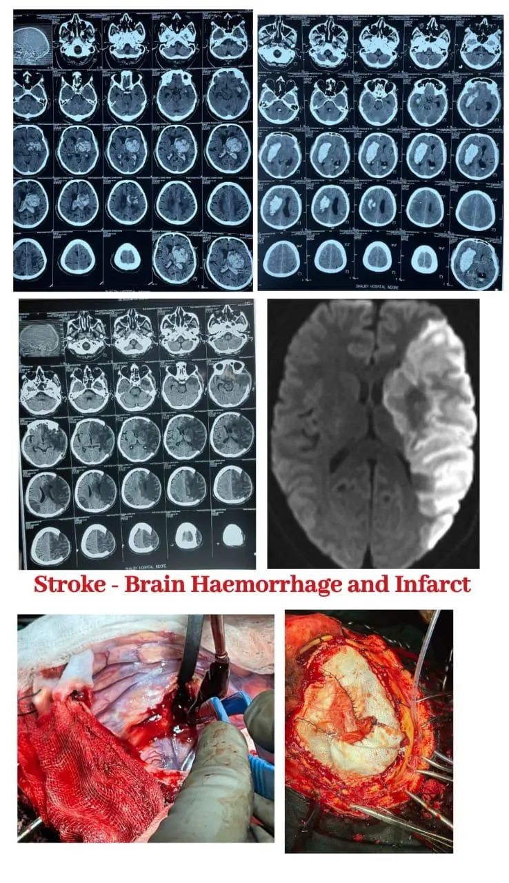 Dr. Abhishek Songara Instagram — Angel Brain & Spine Centre, Indore