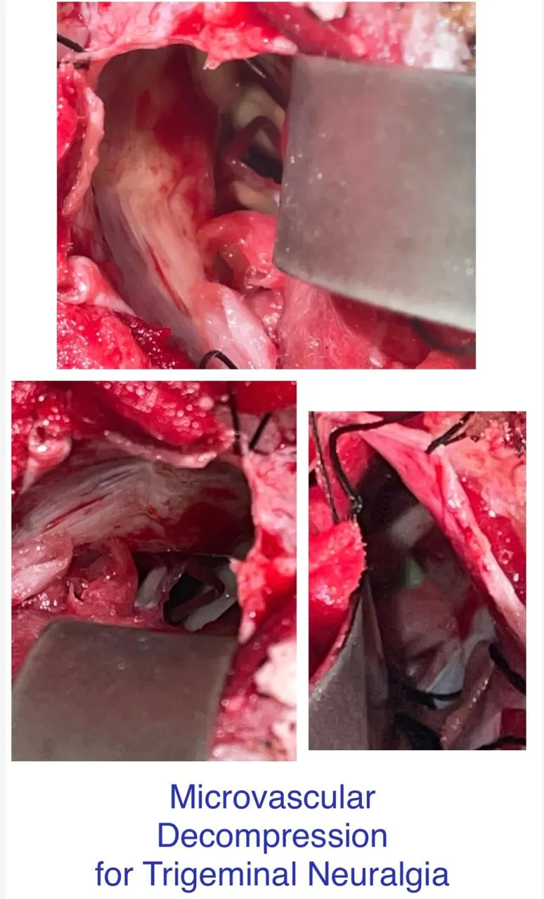 Dr. Abhishek Songara Instagram — Angel Brain & Spine Centre, Indore