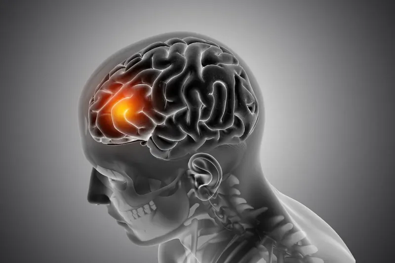 ब्रेन ट्यूमर सर्जरी इंदौर — डॉ. अभिषेक सोंगरा